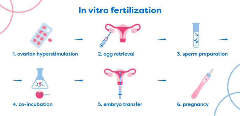 What Is Assisted Reproductive Technology? | IFG