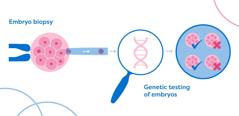 Preimplantation Genetic Screening ( PGS ).jpg