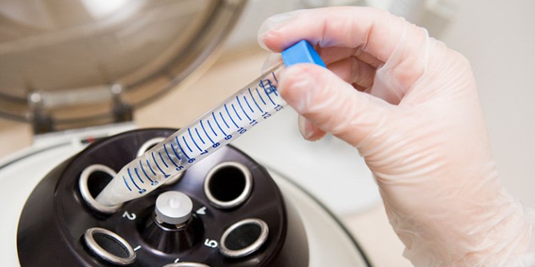What are my options if I decide not to use my stored embryos?